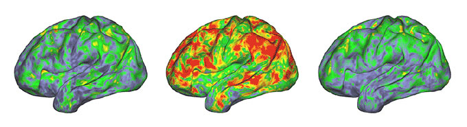 data show neural patterns before, during, and after taking psilocybin